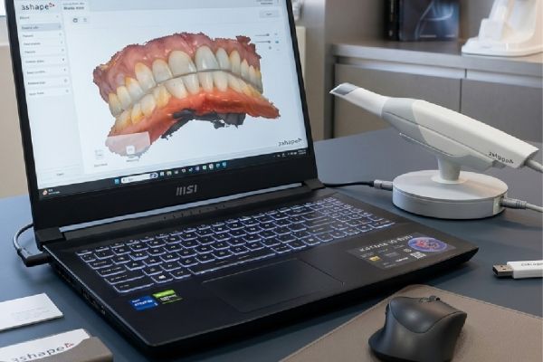 Implantes dentales en Los Cabos