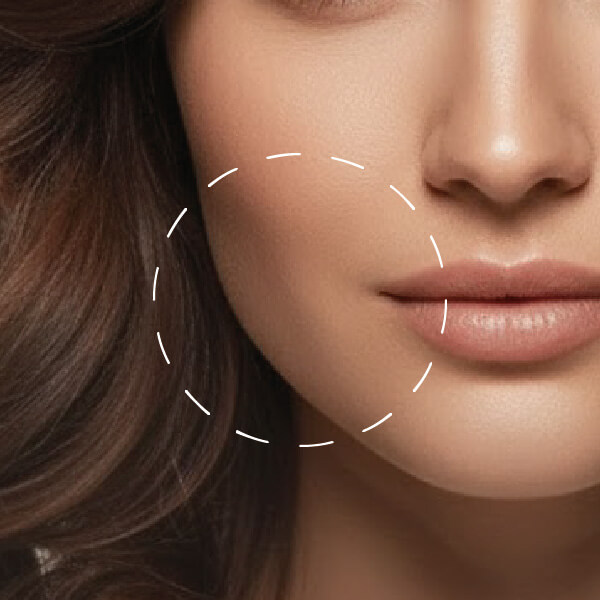 Bichectomy procedure for facial contour enhancement in Los Cabos