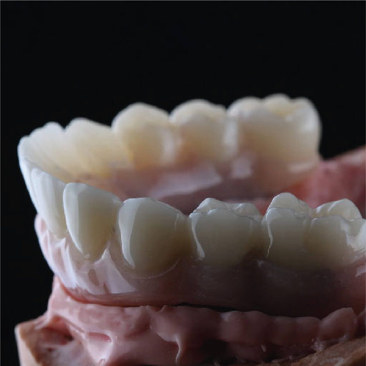 Full Arch Implant Protocols in Los Cabos