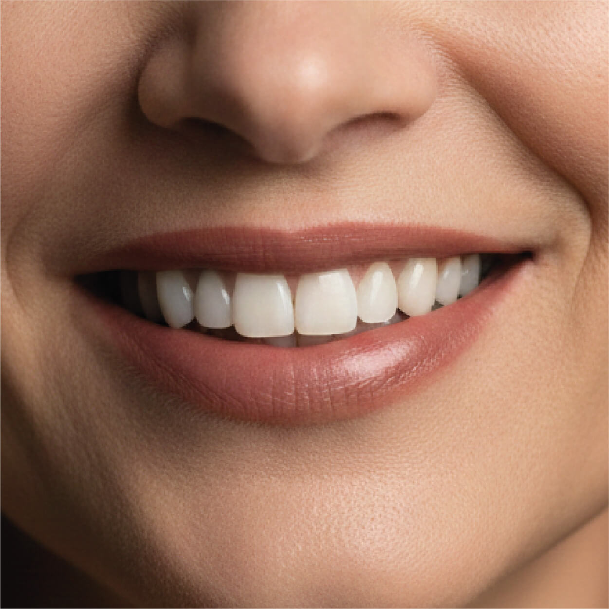 Smile makeover combining cosmetic dental treatments in Los Cabos